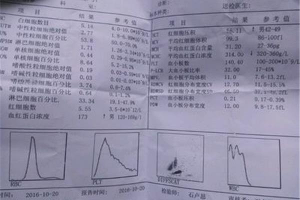 血小板正常是多少