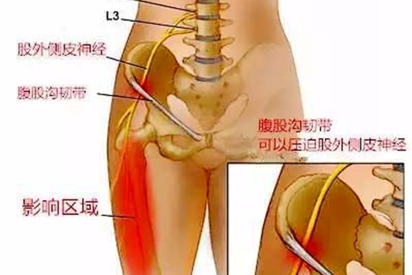 大腿根部内侧疼痛