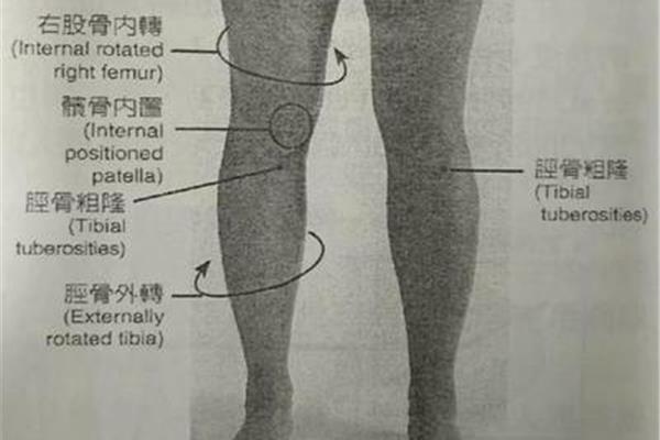 小腿粗壮的原因