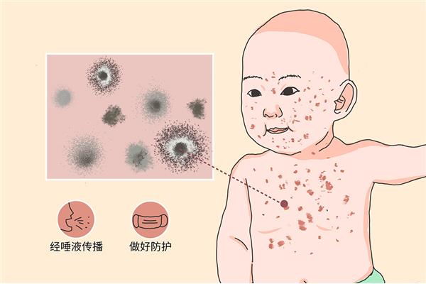 幼儿急疹病原体