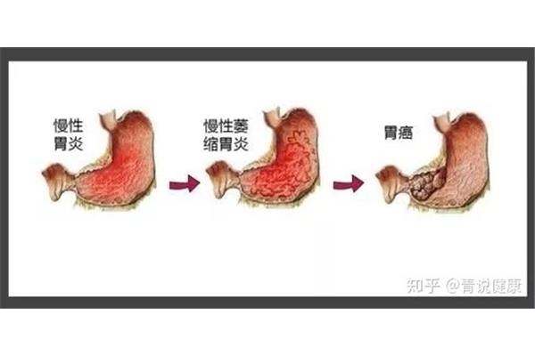 胃的运动形式