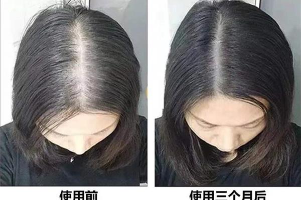 怎么让头发变粗