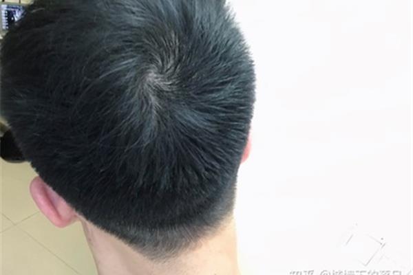 怎么让头发变粗
