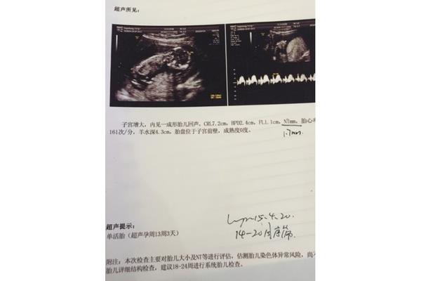 胎儿几个月成型