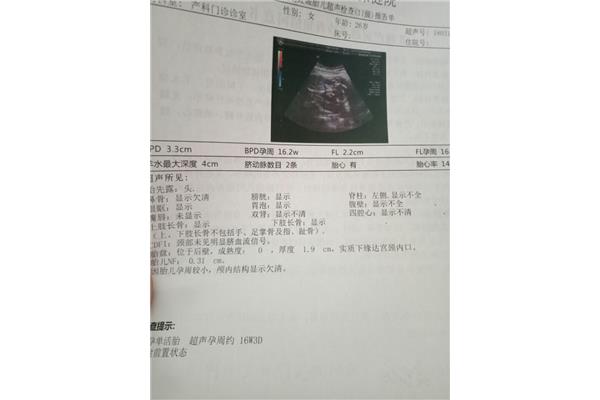 怀孕四个月胎儿