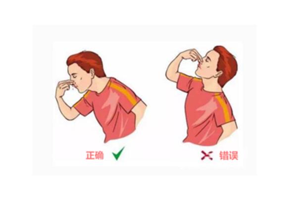 止鼻血的正确方法