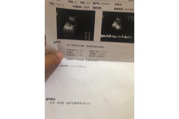 怀孕四个月胎儿