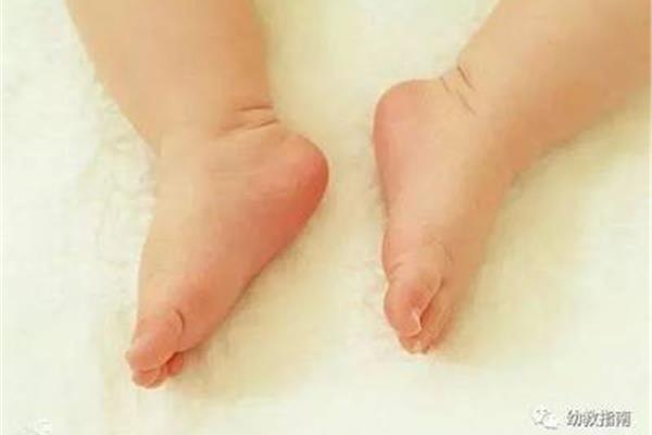 小孩子可以泡脚吗