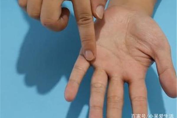 手上茧子怎么去除