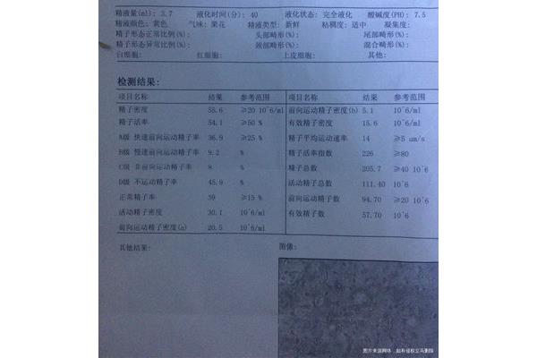 谷丙转氨酶偏低