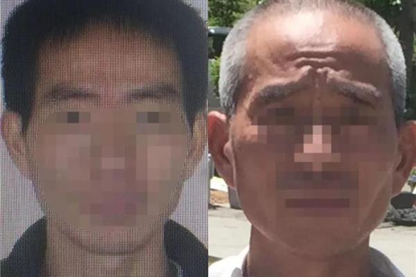遗传性白发