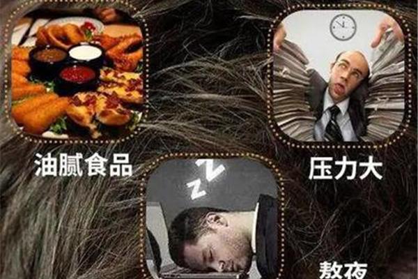 熬夜会导致脱发吗