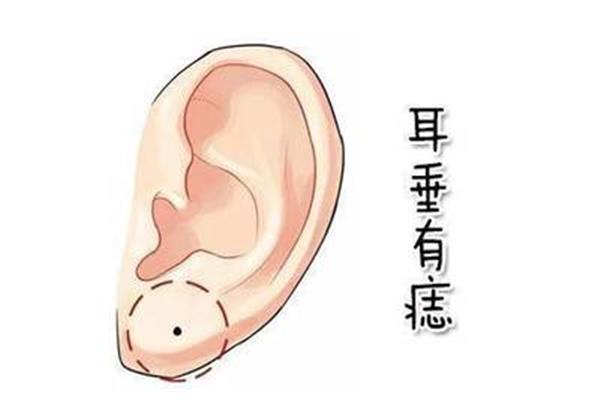 耳垂有痣好不好