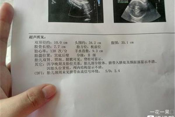 39周股骨长标准