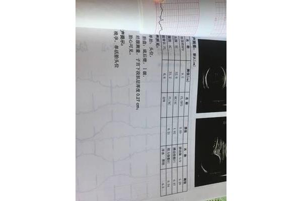 39周股骨长标准