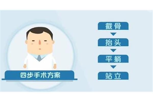 强直性脊柱炎病因