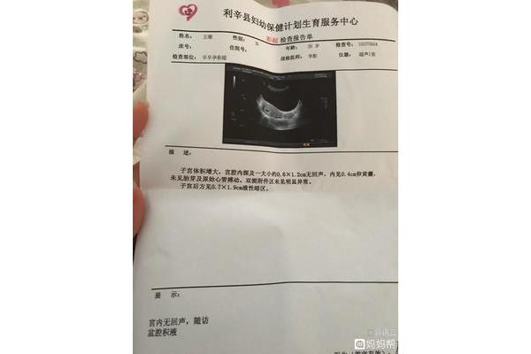 彩超是不是b超