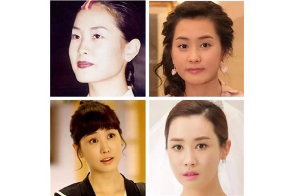 李多海整容前后