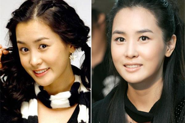 李多海整容前后