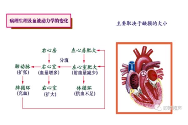 血液动力学