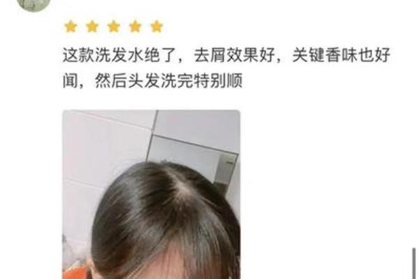 永久去屑的方法