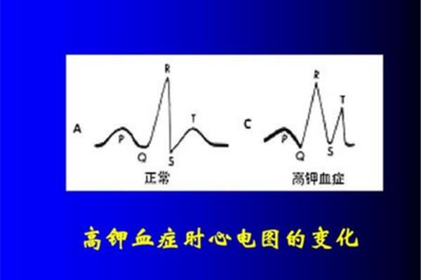 静息电位的特点