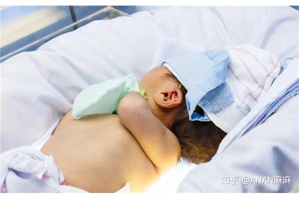 黄疸是什么病