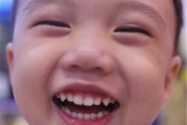 什么样的笑容