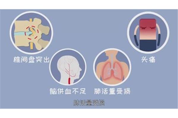肺活量不足怎么办