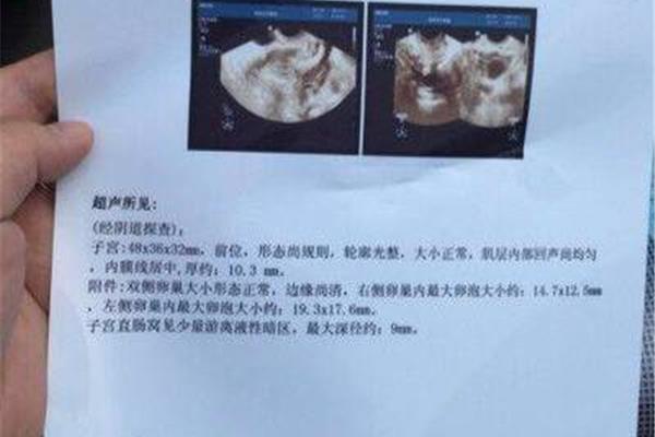 卵泡多大成熟