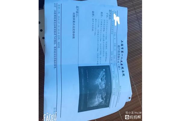 卵泡多大成熟
