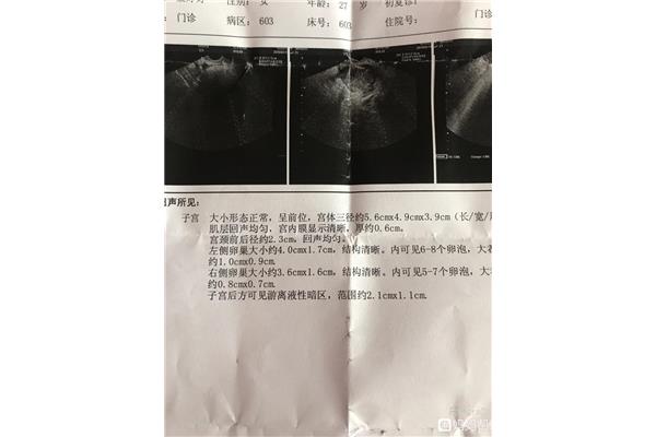 卵泡多大成熟
