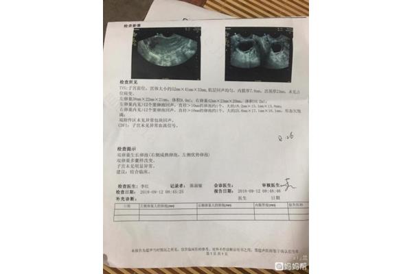 卵泡多大成熟