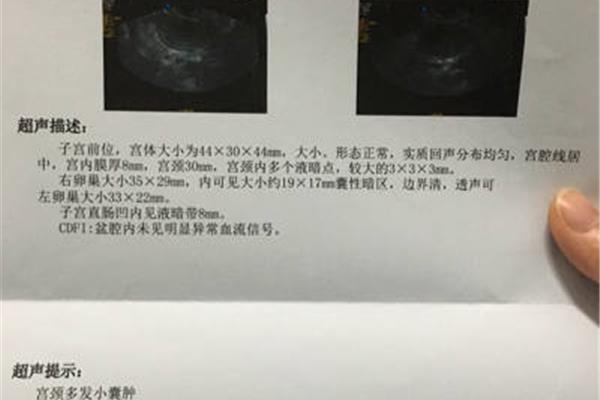 卵泡多大成熟