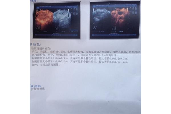 卵泡多大成熟