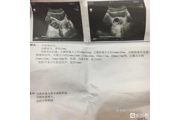 卵泡多大成熟