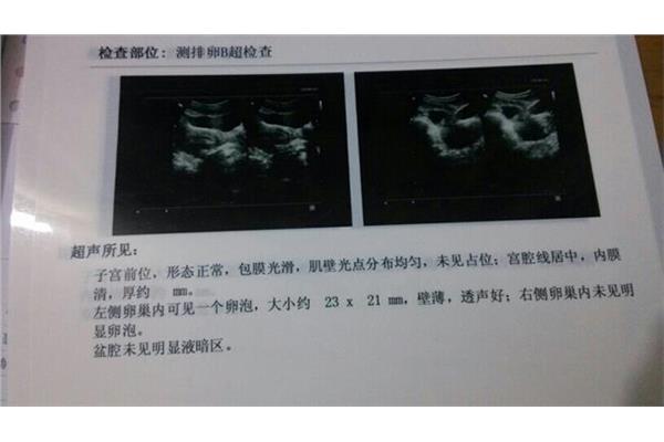 卵泡多大成熟