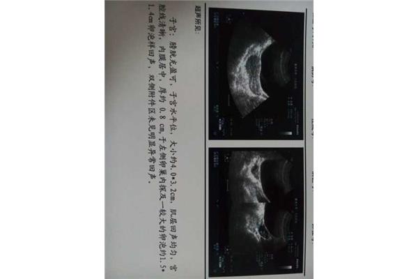 卵泡多大成熟