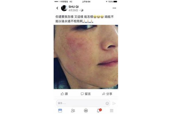 过敏能不能洗澡