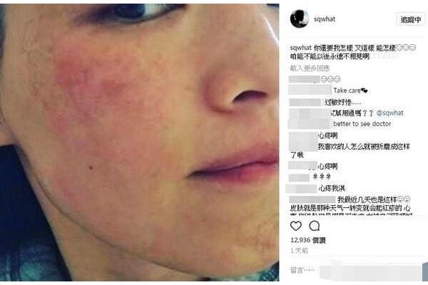 过敏能不能洗澡