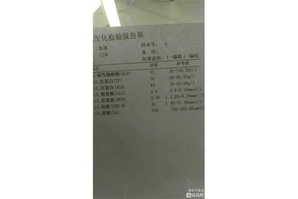 肌酐低怎么回事