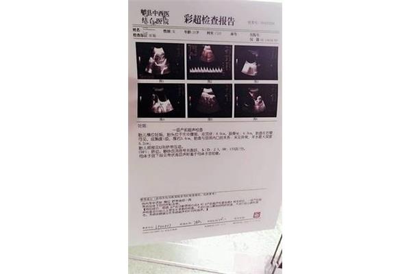 脐带绕颈怎么办