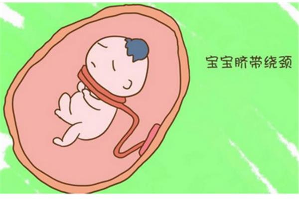 脐带绕颈怎么办