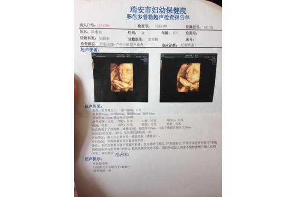 脐带绕颈怎么办