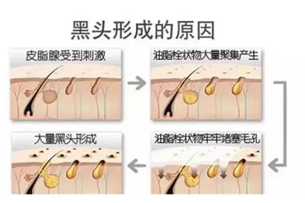 状物是什么意思