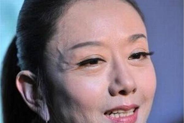 太阳穴有青筋