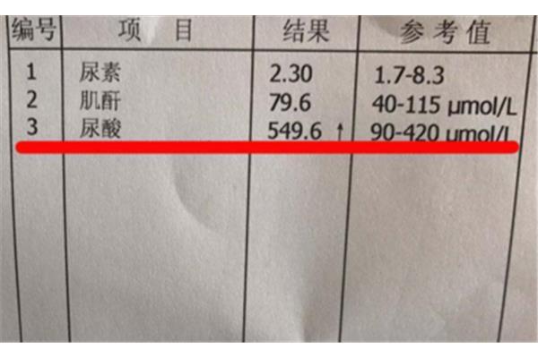 正常肌酐是多少