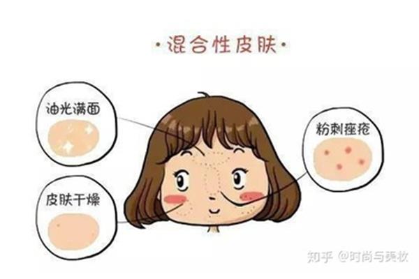 皮肤干燥的原因