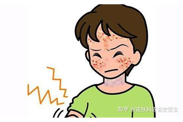 有什么症状