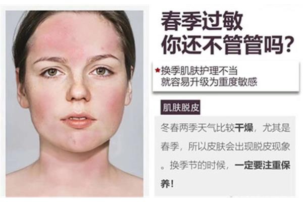 皮肤干燥的原因